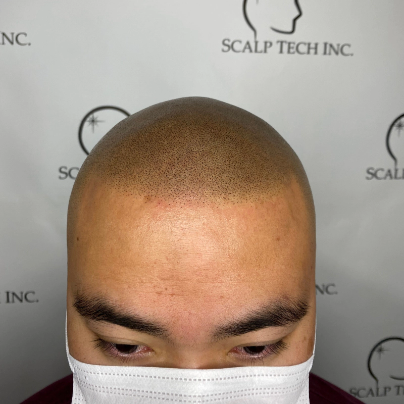 Justin After Scalp Micropigmentation | Scalp Tech Inc.