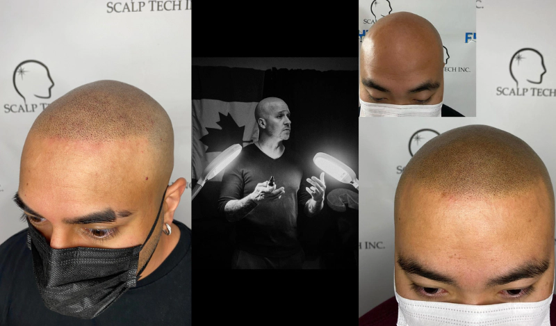 Teaching Scalp Micropigmentation | Scalp Tech Inc.